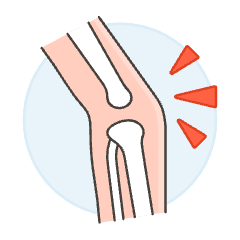 Knee Pain 1 Illustration from UX Colors Set