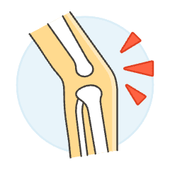 Knee Pain 3 Illustration from UX Colors Set