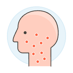 Skin Rash 1 Illustration from UX Colors Set