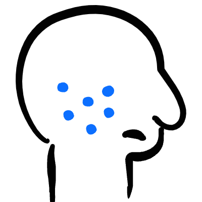 Medical Condition Rashes Icon from Freehand Duotone Set