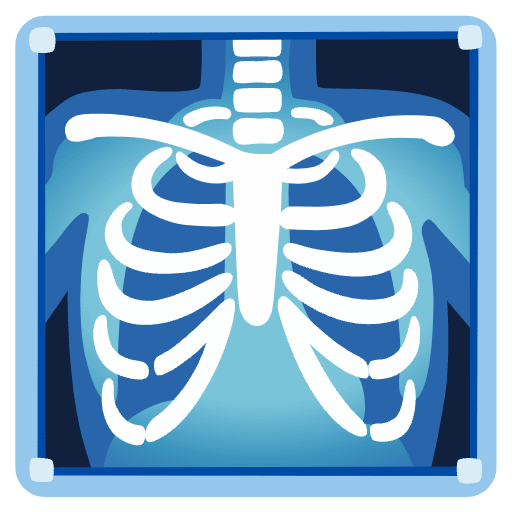 X Ray Emoji from Noto Emojis Set